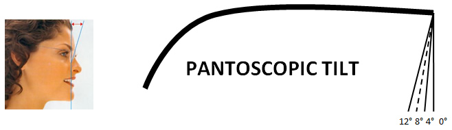 pantoscopic-tilt
